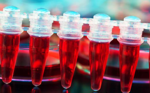Forensic evidence contained with blood can affect the course of a trial.