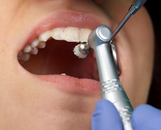 For some dental procedures, a dentist will have to provide direct supervision to a dental hygienist.